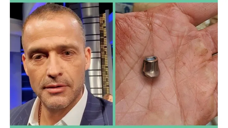 Iván Núñez y la bala que irió uno de sus brazos en el ataque del que fue víctima su equipo.