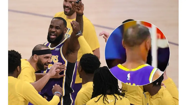LeBron James sufre con la caída del cabello