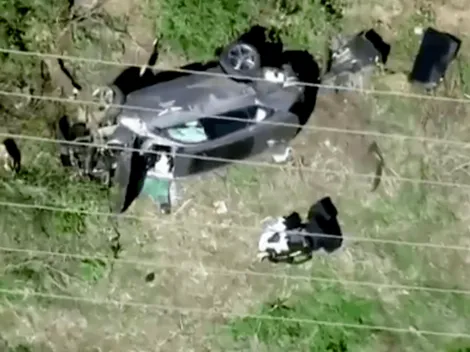 Tiger Woods: confirman graves problemas en su pierna