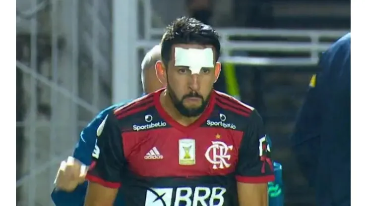 Mauricio Isla terminó evidentemente golpeado en el último partido de Flamengo.