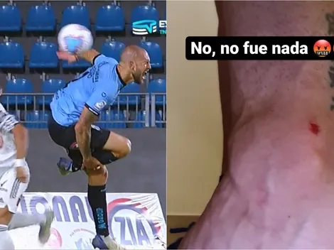 Aveldaño muestra herida en penal no cobrado a Iquique