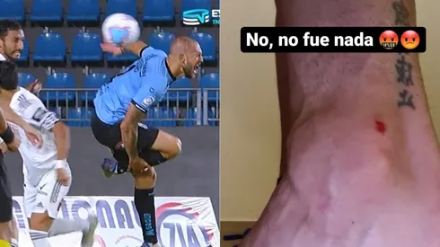 Lucas Aveldaño recibió un pisotón de Julio Barroso en el área que supuestamente le dejó una herida. No fue sancionado como penal por el árbitro de Iquique vs Colo Colo