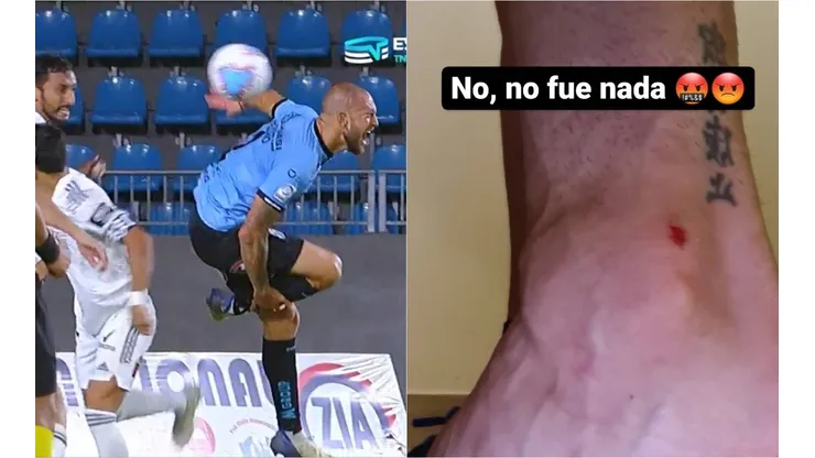 Lucas Aveldaño recibió un pisotón de Julio Barroso en el área que supuestamente le dejó una herida. No fue sancionado como penal por el árbitro de Iquique vs Colo Colo
