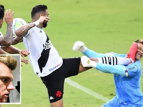 Tremendo planchazo en la cara impacta en Brasil