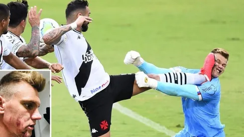 El portero debió recibir 5 puntos de sutura.