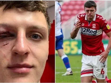 Defensor del Middlesbrough casi pierde un ojo