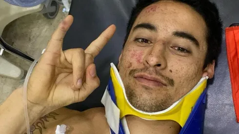 El chileno se realizará exámenes médicos para evaluar las lesiones en su cabeza.