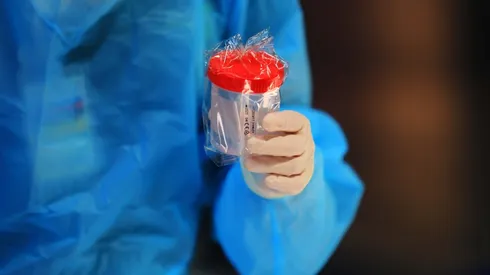 Toma de muestra Covid-19