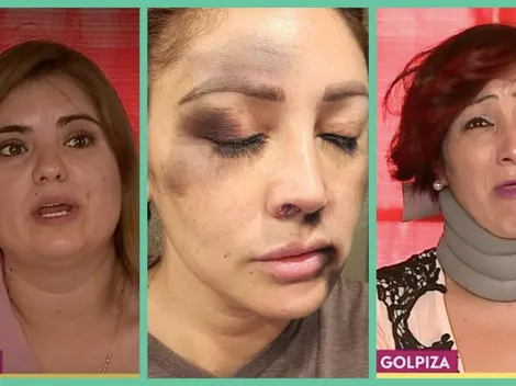 Supuestas agresoras de "La Rancherita" desmienten a la cantante