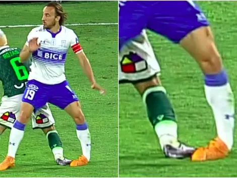 Escalofriante torcedura de tobillo del Chapa Fuenzalida