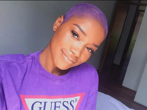 Keke Palmer muestra como quedo su piel tras complejo síndrome