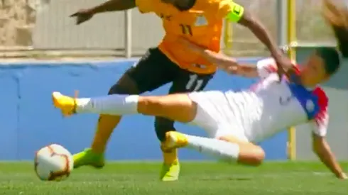 Carla Guerrero cayó mal y luxó su codo izquierdo