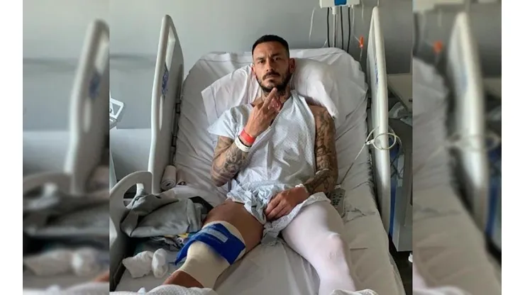 Mauricio Pinilla se sometió a una cirugía de menisco.