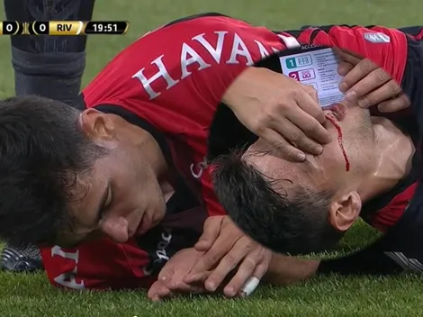 Léo Cittadini pierde un diente contra River Plate