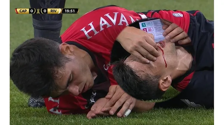 Santiago Sosa se llevó un diente de Léo Cittadini en el Paranaense-River Plate.