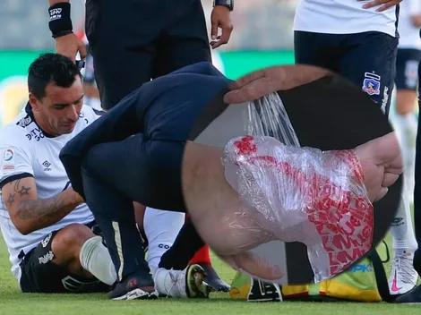 Colo Colo suma otro problema: se lesiona Paredes