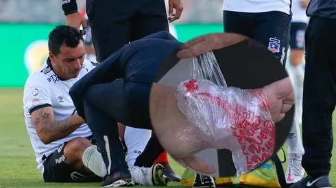 Esteban Paredes sale lesionado en Colo Colo contra Audax Italiano.