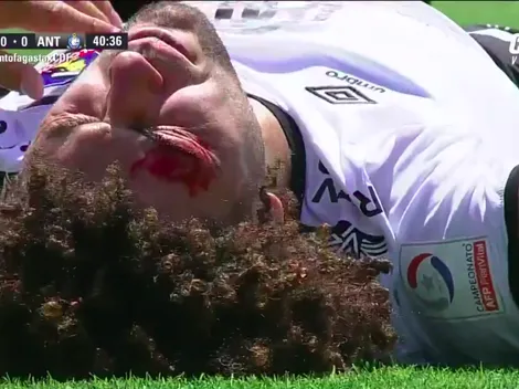 Falcón deja la vida en su debut: se gana codazo y un corte