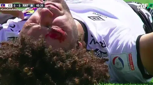 Falcón terminó con un feo corte tras un golpe de Carlos Muñoz