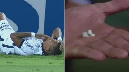 El árbitro del partido muestra los dientes de Rómulo Otero