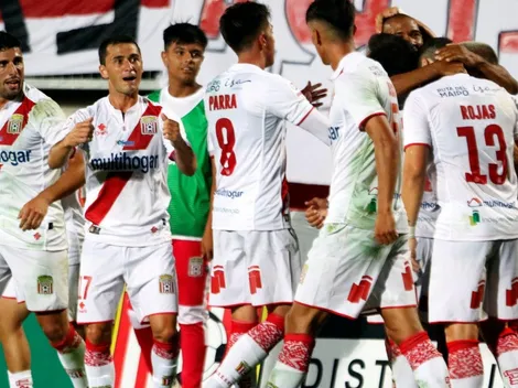 Curicó confirma que un jugador dio positivo por Covid-19