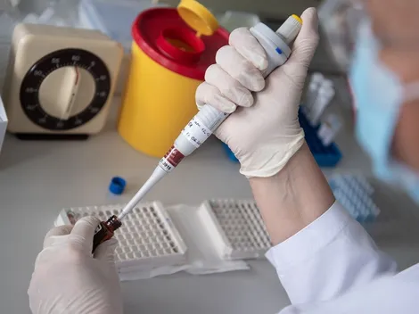 Estudio sugiere que los anticuerpos contra el coronavirus no duran más de tres meses después de la infección