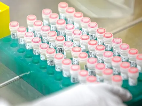 Revisa el estado de las principales vacunas candidatas para derrotar al coronavirus