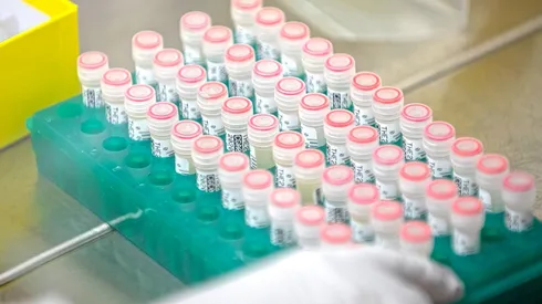 Las principales vacunas para el coronavirus están en fase de pruebas con humanos.