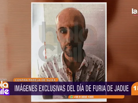 Revelan fotos de Jadue ensangrentado tras recibir una golpiza en Miami