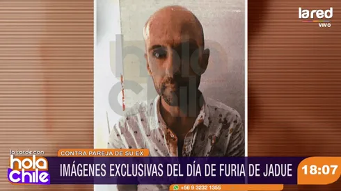 Jadue terminó ensangrentado.