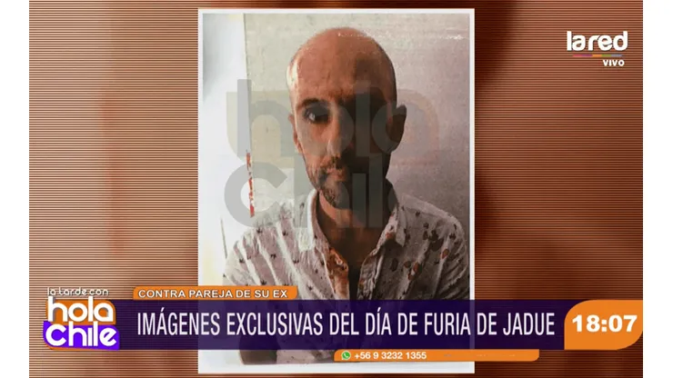 Jadue terminó ensangrentado.