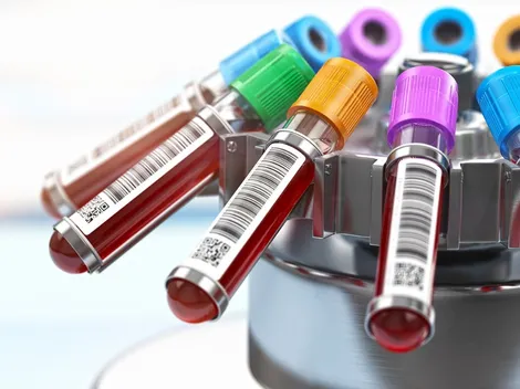 Buscan a donantes de sangre recuperados de Covid-19 para revolucionario tratamiento