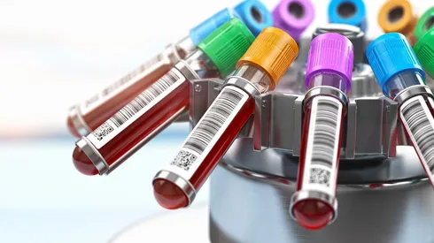 De un donante se puede obtener el plasma para tratar a tres contagiados.