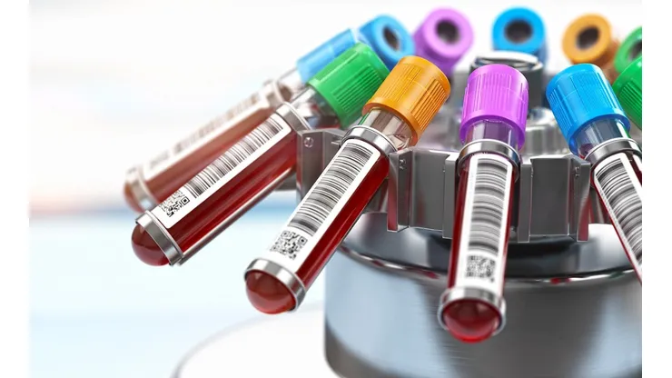 De un donante se puede obtener el plasma para tratar a tres contagiados.