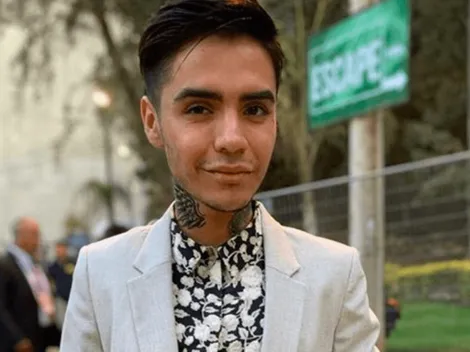 Leo Mendez Jr. sufre ataque y termina con un ojo totalmente morado