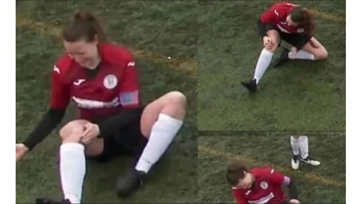 La futbolista sufrió una dolorosa lesión y siguió jugando el partido.