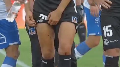 Blandi fue herido por el artificio