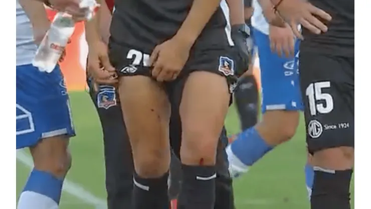 Blandi fue herido por el artificio