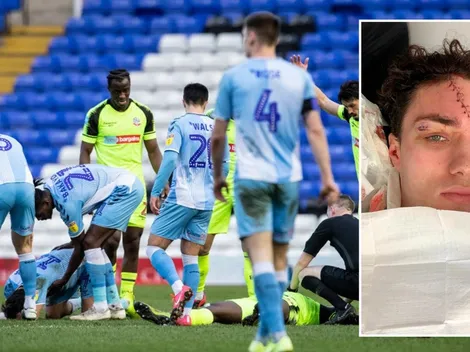 Futbolista inglés sigue jugando pese a tener su cara completamente cortada