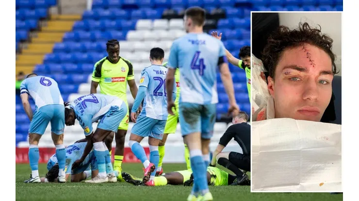 Tremendo: futbolista inglés sigue jugando pese a tener su cara completamente cortada