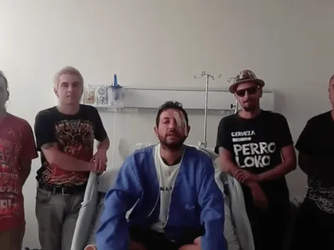 Músico de Anarkía Tropikal perdió un ojo