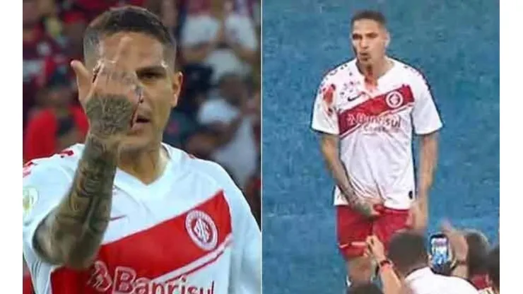 A Paolo Guerrero se le sale la cadena con su ex equipo: le cortan la cara, insulta al árbitro y se va expulsado