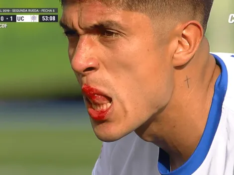 Valber Huerta queda sangrando y casi pierde un diente en el clásico universitario