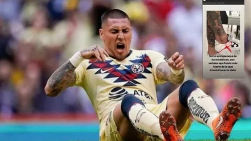 Castillo aún está en recuperación