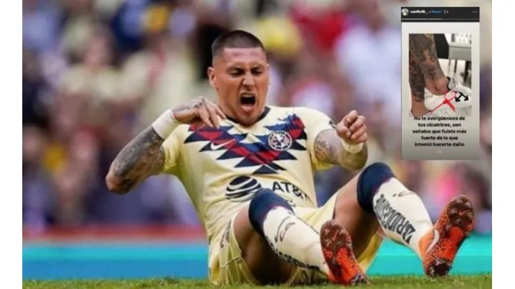 Castillo aún está en recuperación
