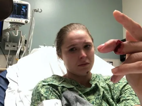 Ronda Rousey casi pierde un dedo en grabación de 9-1-1