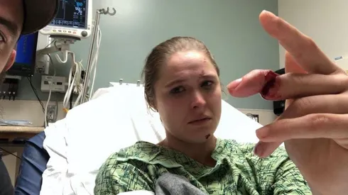 Ronda Rousey casi pierde un dedo en grabación de 9-1-1