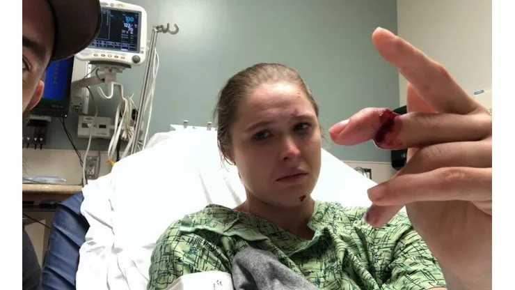 Ronda Rousey casi pierde un dedo en grabación de 9-1-1