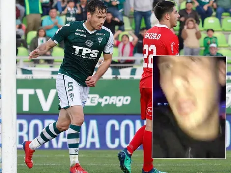 Jugador de S. Wanderers ataca a jóvenes que lo grababan en discoteque