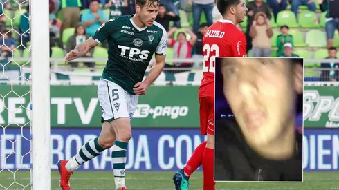 Jugador de Santiago Wanderers es visto en una discoteque y ataca a jóvenes que lo grababan (Foto: Agencia Uno)